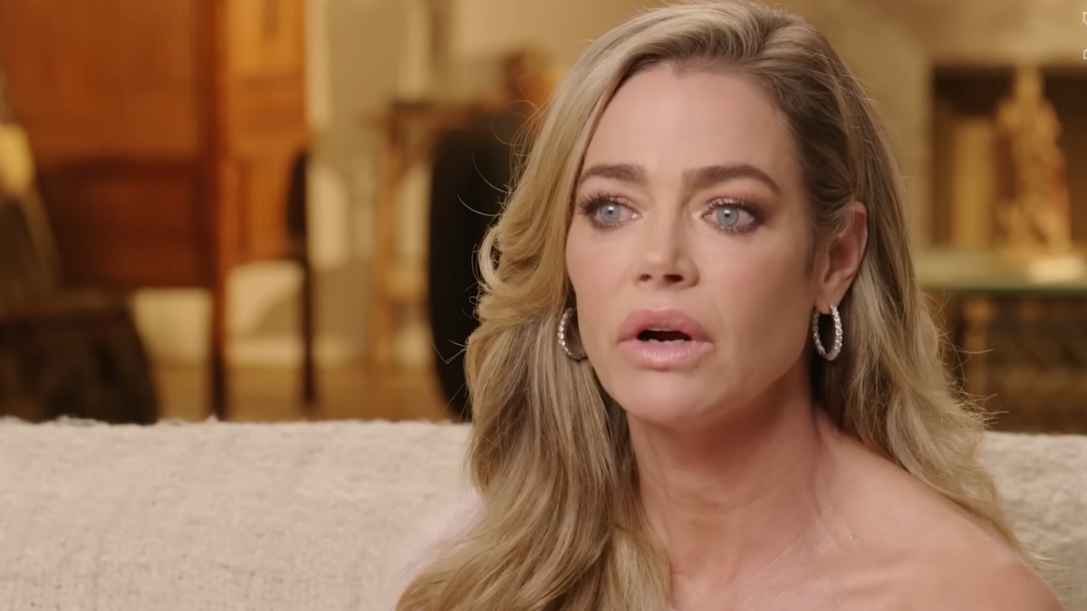 Denise Richards facelift results